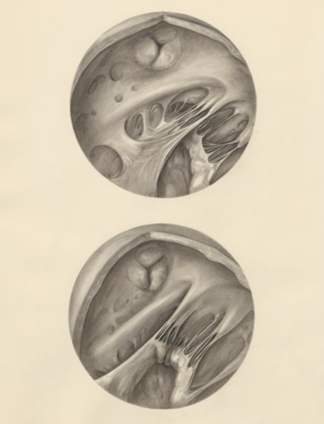 H.G Wetselaar, Two microscopic magnifications of parts of the heart