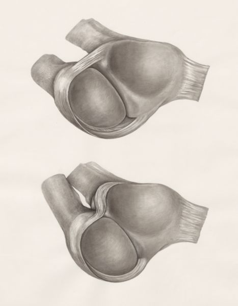 H.G Wetselaar, Joints of the hand or fingers