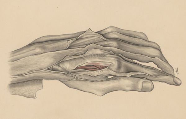 J Tinkelenberg, Muscular tissue of the hand
