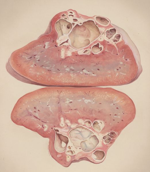 J Wetselaar-Whittaker, Lung tissue