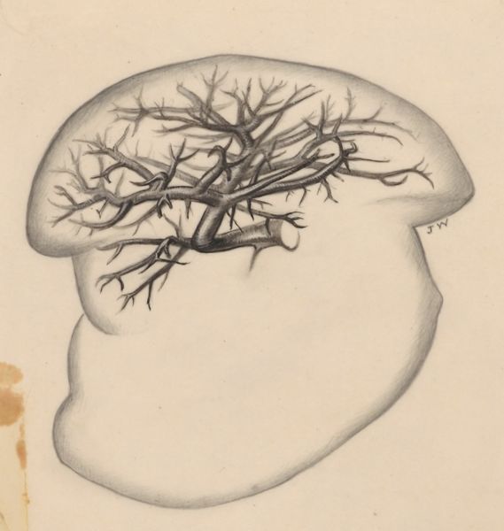 J Wetselaar-Whittaker, Bronchi