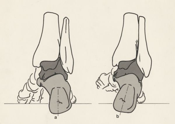 J Tinkelenberg, Schematic representation of the feet