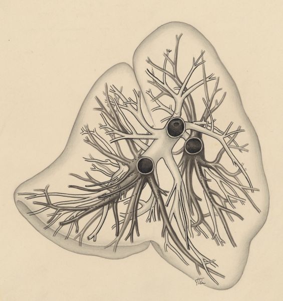 J Tinkelenberg, Bronchi