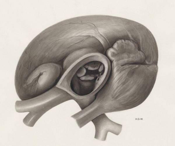 H.G Wetselaar, Heart and adjacent organs