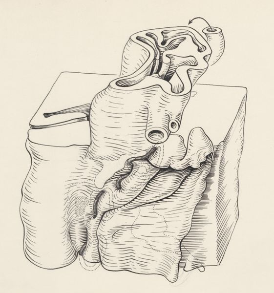 J Tinkelenberg, Cross section of a heart