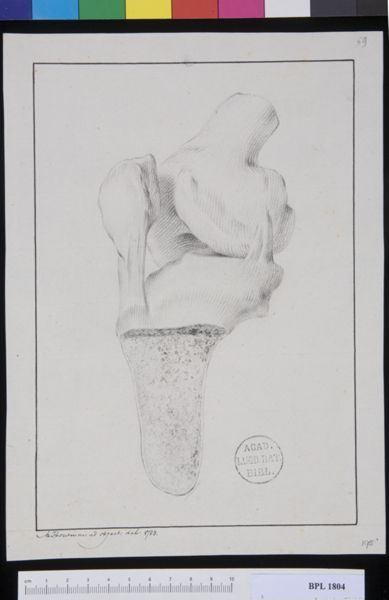 M. Houtman, Pathology, fractures (Knee)