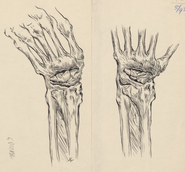 J Tinkelenberg, Musculoskeletal system of the hand and wrist