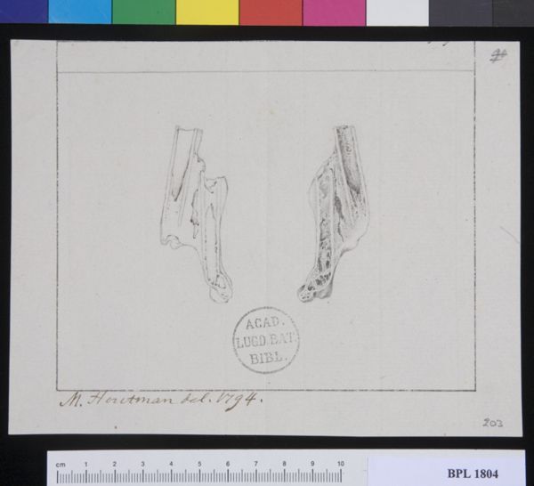M Houtman, Pathology, fractures (Femur)