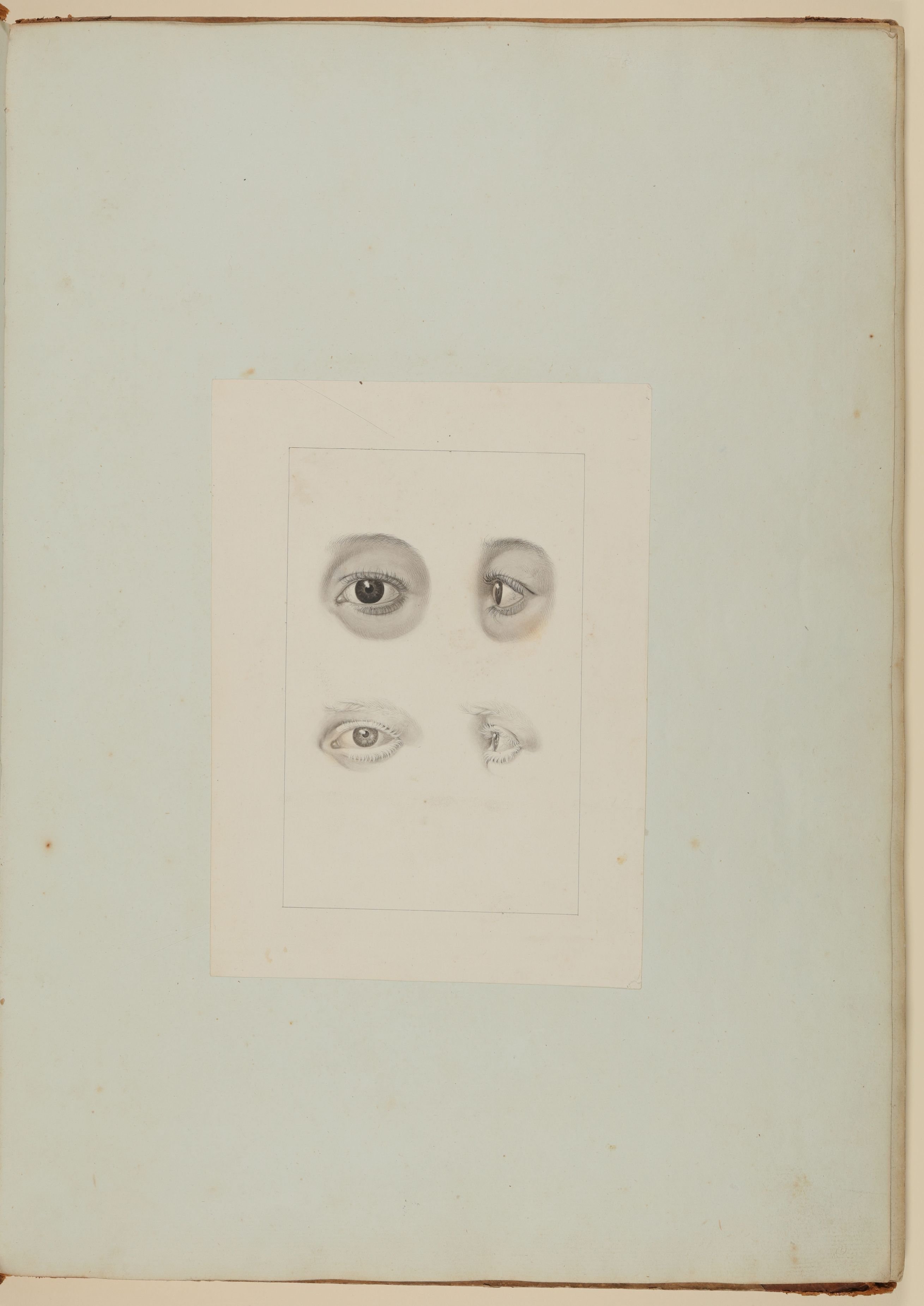 Christian Koeck, Darstellungen des menschlichen Auges, darunter das Auge eines von Albinismus betroffenen elfjährigen Mädchens, frontal und im Profil gesehen [Nicht verwendete Augenstudie sowie Vorzeichnung zu Samuel Thomas Soemmerring, Abbildungen des menschlichen Auges, Frankfurt am Main 1801, Tafel I ("schattier…