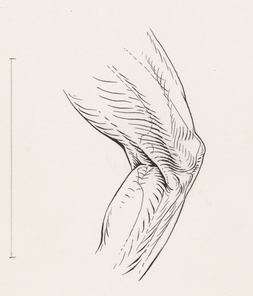 J Tinkelenberg, Knee joint