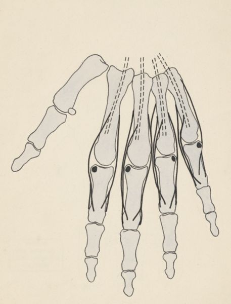 J Tinkelenberg, Schematic representation of the fingers
