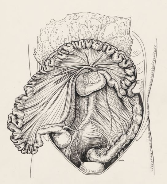 J Wetselaar-Whittaker, Intestinal tissue