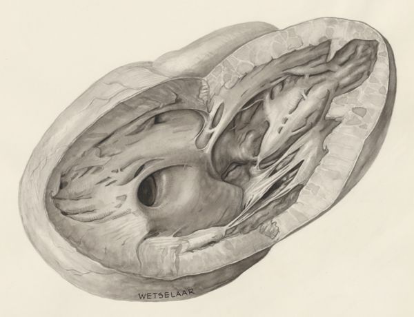 H.G Wetselaar, Heart