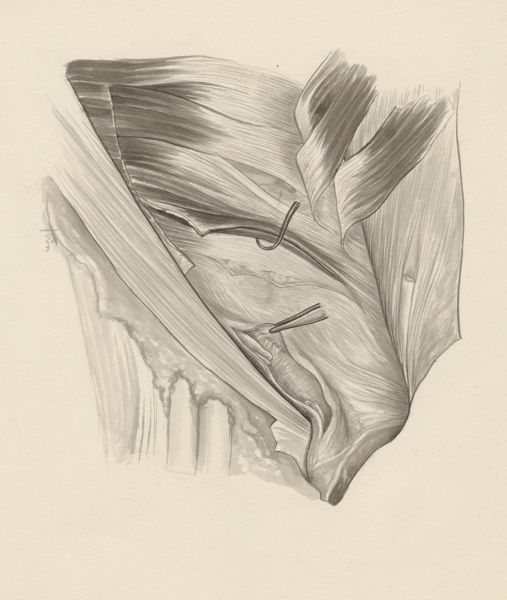 J Tinkelenberg, Cardiovascular system