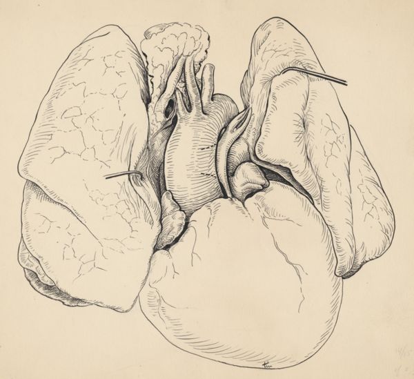 J Tinkelenberg, Part of the heart and circulatory system
