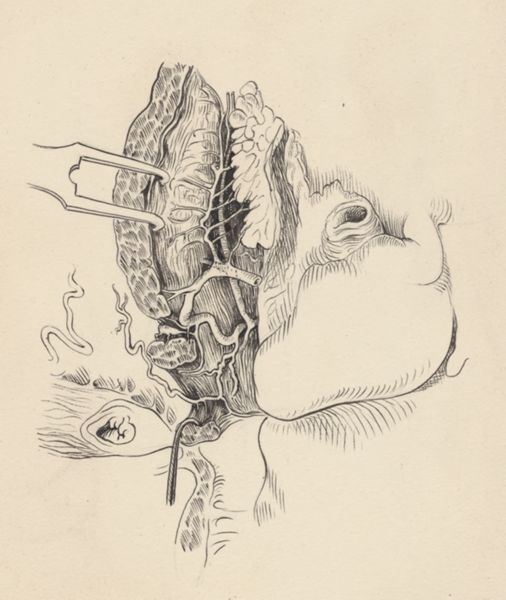 J Tinkelenberg, Part of the heart and circulatory system