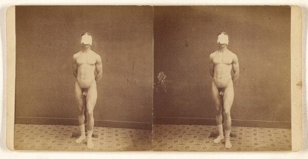 Unknown, [Frontal view of nude man with face covered]