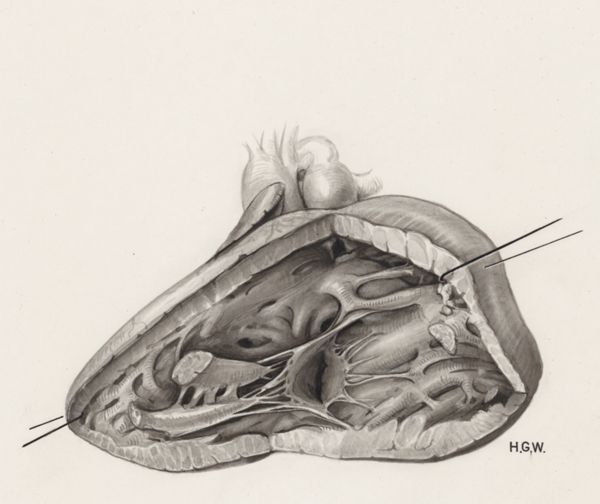 H.G Wetselaar, Heart and adjacent organs
