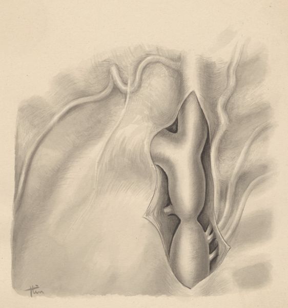 J Tinkelenberg, Part of the heart and circulatory system