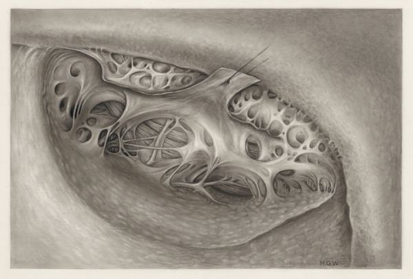 H.G Wetselaar, Tissue of the buttocks