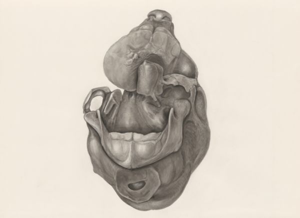 H.G Wetselaar, Deformed fetal head, seen from below