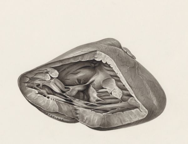 H.G Wetselaar, Cross section of a heart