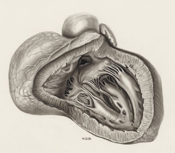 H.G Wetselaar, Heart