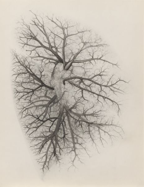 J Tinkelenberg, Bronchi