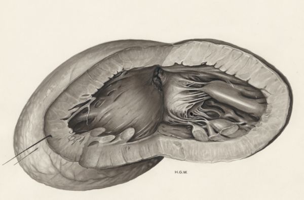 H.G Wetselaar, Heart