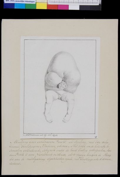 M Houtman, Foetus