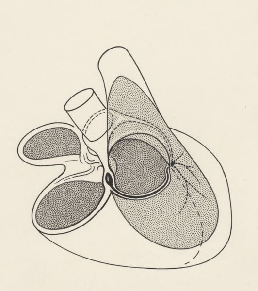 J Tinkelenberg, Schematic representation of the heart and circulatory system
