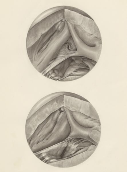 H.G Wetselaar, Two microscopic magnifications of parts of the heart