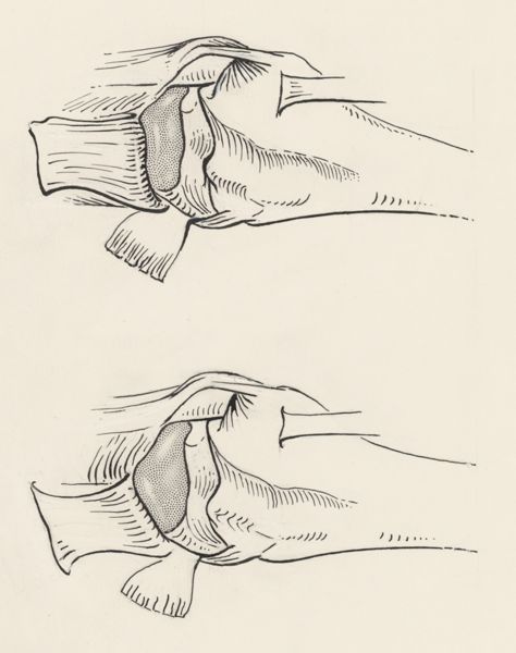 J Wetselaar-Whittaker, Musculoskeletal system of the upper extremity