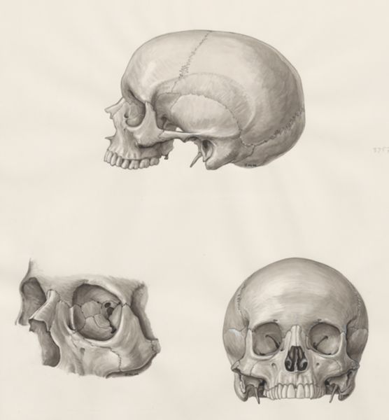 J Wetselaar-Whittaker, Skull seen from three sides