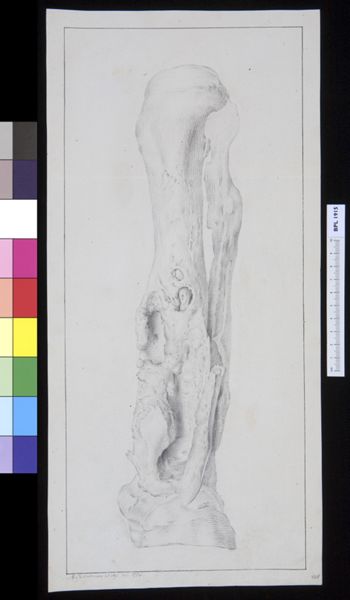 M Houtman, Bone