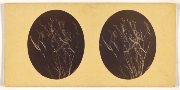 Unknown, [Microscopic bacteria or flora]