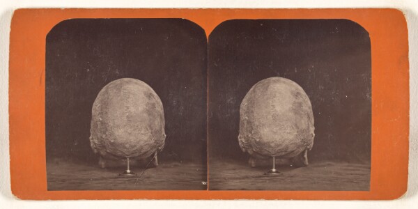 Unknown, Posterior View of a Cranium. From an ancient tumulus near Fort Wadsworth, Dakota Territory.