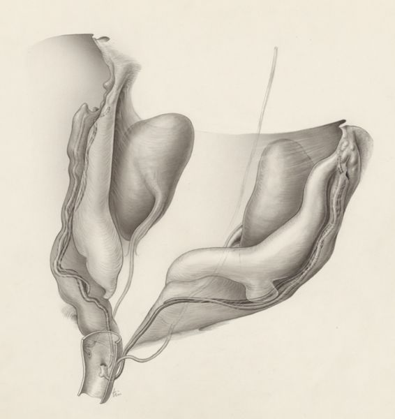 J Tinkelenberg, Urogenital system of the human embryo