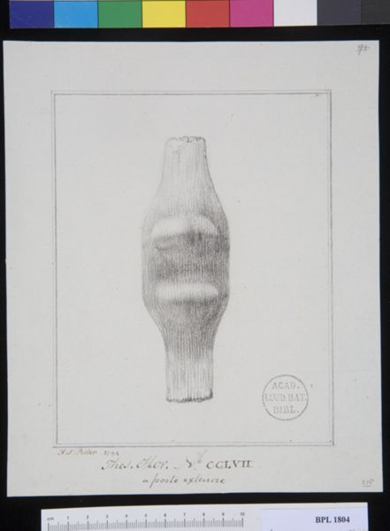 Poster, H.J, (active, Pathology, fractures (Patella)