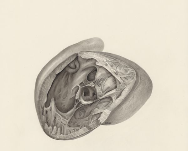 H.G Wetselaar, Cross section of a heart