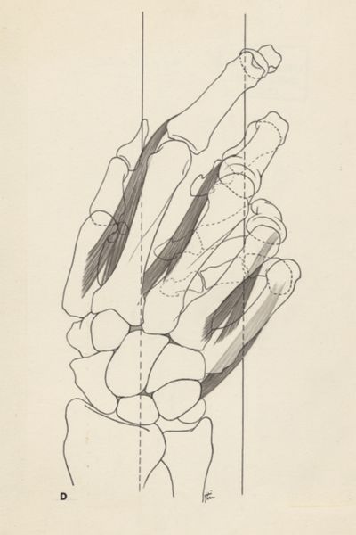 J Tinkelenberg, Schematic representation of the hand
