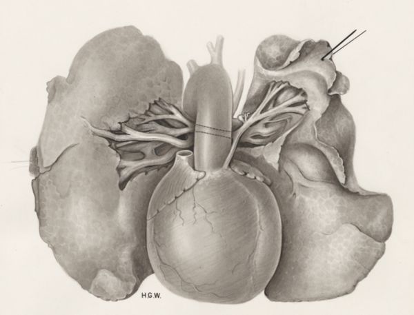 H.G Wetselaar, Heart and adjacent organs