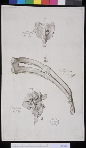 M Houtman, Pathology, fractures