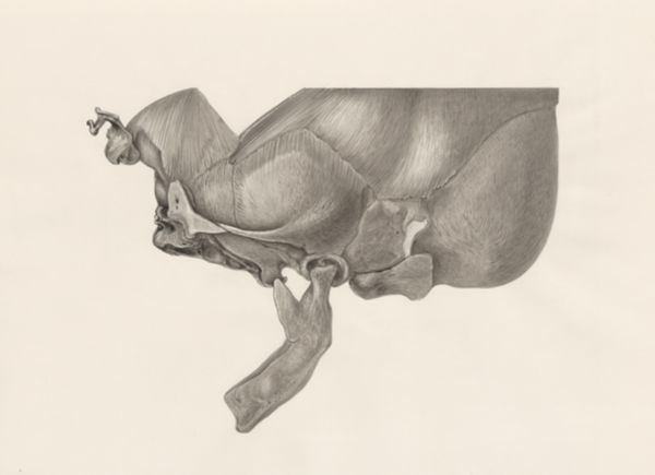H.G Wetselaar, Deformed jawbone