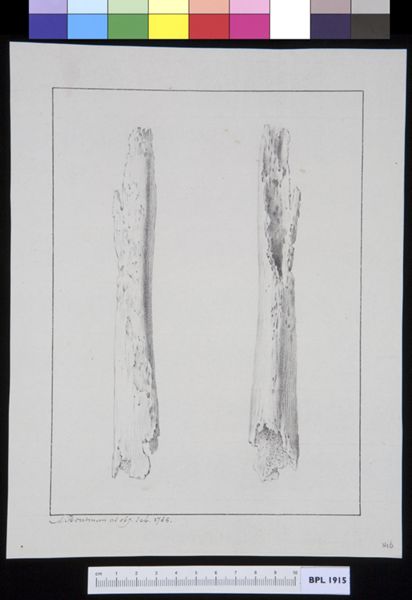 M Houtman, Infected bone