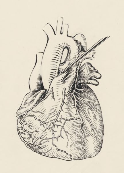 J Tinkelenberg, Heart