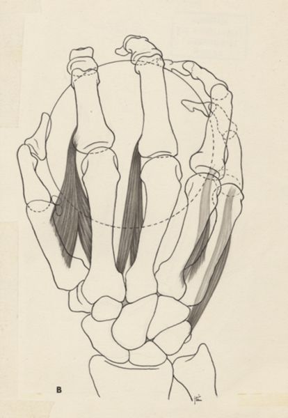 J Tinkelenberg, Schematic hand, holding a ball