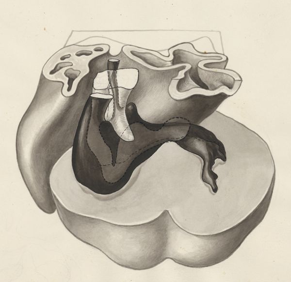 J Tinkelenberg, Embryonic heart
