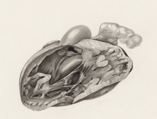H.G Wetselaar, Cross section of a heart