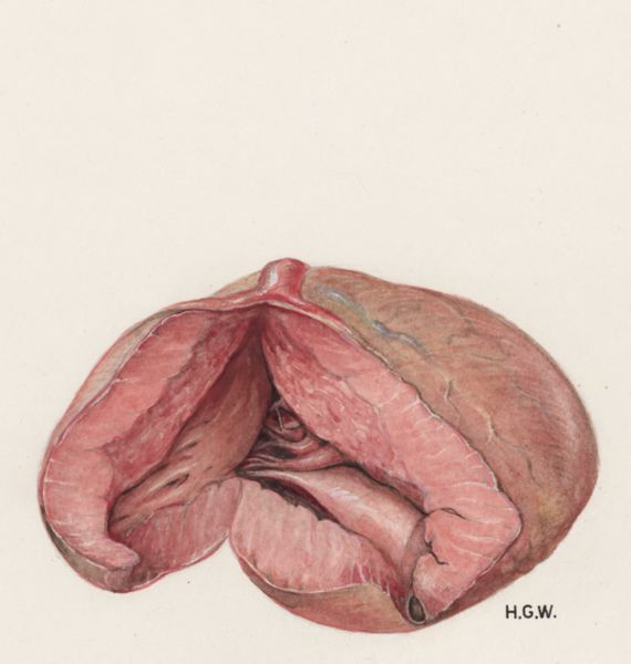 H.G Wetselaar, Heart and adjacent organs